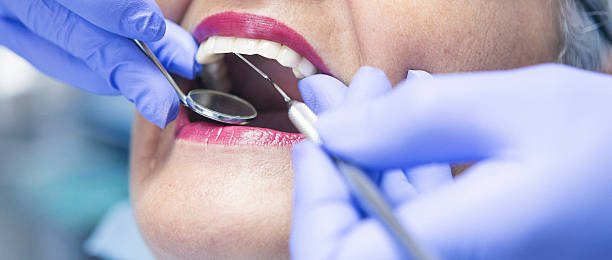 Best Urgent Care for Lost Fillings or Crowns in Shelby, MS